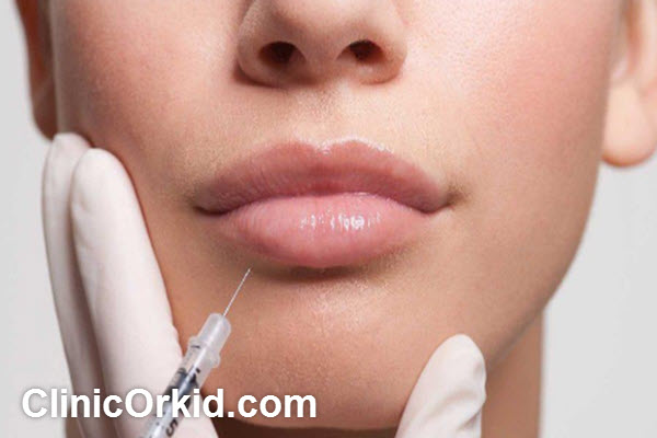 بررسی اهمیت انتخاب پزشک متخصص برای تزریق فیلر | کلینیک ارکید