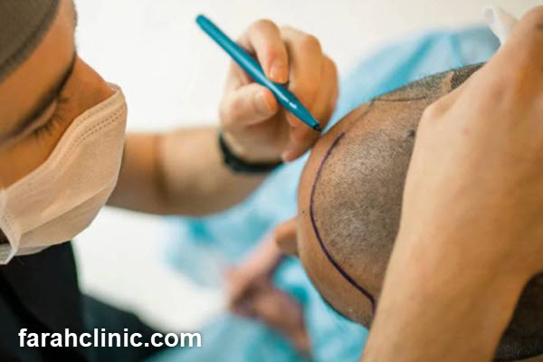 بررسی اهمیت تخصص و تجربه پزشک در موفقیت عمل | فرح کلینیک