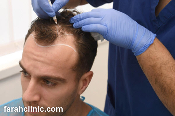 مراقبت های پس از عمل و پشتیبانی مستمر | فرح کلینیک