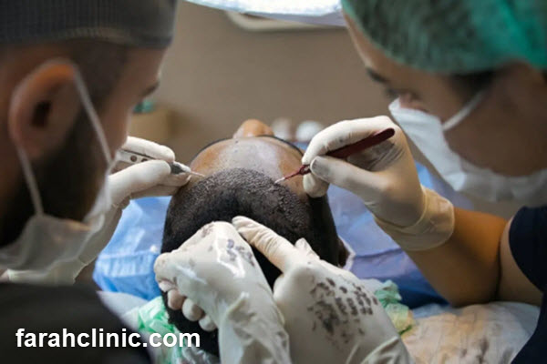 کلینیک کاشت مو در غرب تهران